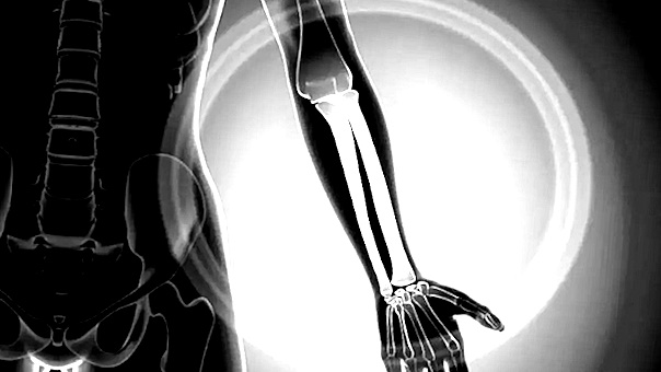 PowerSupplements | Zo zorg je voor onbreekbare botten